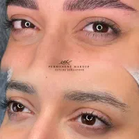 مدل برای میکروبلیدینگ و شیدینگ یک میلیون