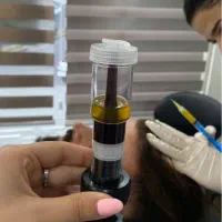 بوتاکس و prp و لاغری