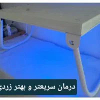 اجاره دستگاه زردی
