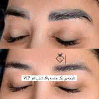 ریمو کاملا تخصصی تضمینی با مدرس بین الملی|خدمات آرایشگری و زیبایی|آبادان, |دیوار