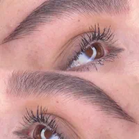 میکروبلیدینگ،فیبروز،شیدینگ لب