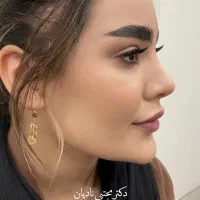 جشنواره جراحی عمل بینی ۲۴ میلیون،بلفارو لیفت