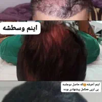 پی ارپی صورت ومو ومزوتراپی صورت ومو تخفیف ویژه|خدمات آرایشگری و زیبایی|کازرون, |دیوار