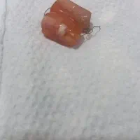 مهره عقیق و شجر بکر