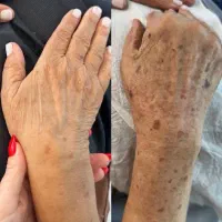 جشنوار یلدا درمان تضمینی کک ومک/لک/خال/فقط در1جلسه|خدمات آرایشگری و زیبایی|اصفهان, باغ زیار|دیوار