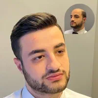 پروتز مو  سنندج|خدمات آرایشگری و زیبایی|سنندج, |دیوار