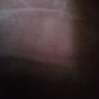 وایر رینگ پراید