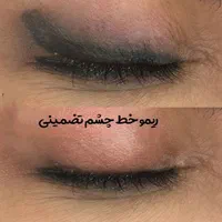 ریموو تخصصی تتو با مواد گیاهی اروپا تک جلسه|خدمات آرایشگری و زیبایی|تهران, دهکده المپیک|دیوار