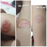 پاسخگوی مشکلات پوستی|فعالیت داوطلبانه|رفسنجان, |دیوار