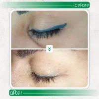 پاک کردن تاتوومیکروبلیدینگ بدون لیزر+آموزش بامدرک