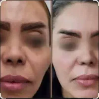 کرم Vip معجزه|آرایشی، بهداشتی، درمانی|یاسوج, |دیوار