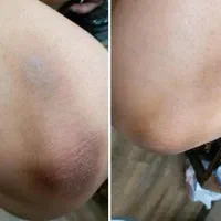 ازبین بردن تیرگی ،ازبین بردن ترک عمیق پا|خدمات آرایشگری و زیبایی|بوشهر, |دیوار