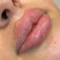 با خدمات کلینیک پلاتین،زیبایی خودراصدچندان کنید