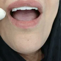 کلینیک تخصصی ایمپلنت با اقساط بلندمدت|خدمات آرایشگری و زیبایی|تهران, قیطریه|دیوار