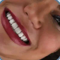 خدمات دندانپزشکی اقساطی/کامپوزیت/ایمپلنت/عصبکشی|پزشکی|تهران, مهران|دیوار