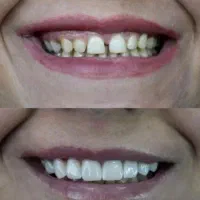 کلیه خدمات دندانپزشکی مناسب همه