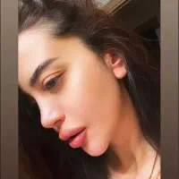 جراحی زیبایی بینی فقط با ۳۰میلیون(دکتراسدالله پور)