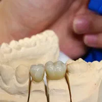 لابراتوار پروتز دندانی ادیب|آرایشی، بهداشتی، درمانی|گلبهار, شهر جدید گلبهار|دیوار