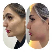 تخفیف ویژه جشنواره تابستانه مطب زیبایی دکتر شمشیری|خدمات آرایشگری و زیبایی|اردبیل, |دیوار