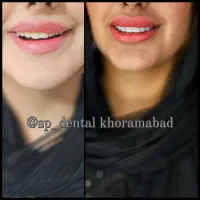 مرکز دندان اسپی دنتال