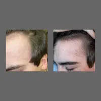 عوض شو|آرایشی، بهداشتی، درمانی|چرام, |دیوار