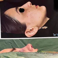 جشنواره بینظیر واستثنایی جراحی زیبایی بینی و صورت