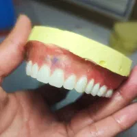 دندانسازی دندان مصنوعی|خدمات آرایشگری و زیبایی|نیشابور, امام خمینی|دیوار