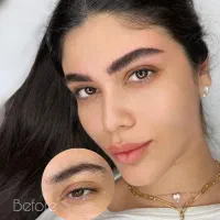 ۲ مدل فیبروز ابرو توسط استاد