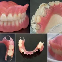 ساخت پروتز متحرک دندان کیفیت عالی و قیمت مناسب