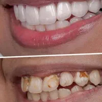 دندان سازی ویتا خدمات و ساخت دندان|پزشکی|بابل, |دیوار