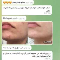 محصولات آرایشی و بهداشتی تراست|آرایشی، بهداشتی، درمانی|مسجد سلیمان, |دیوار