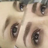 مدل میکروبلیدینگ