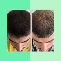 چی بهتر از این روش