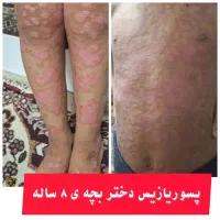 روغن تراپی|آرایشی، بهداشتی، درمانی|نهبندان, |دیوار