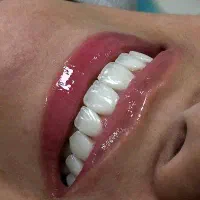 منشی و دستیار دندان پزشک (زیبایی)