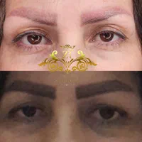 ریموو تخصصی تاتو و میکروبلیدینگ با رجووی|خدمات آرایشگری و زیبایی|زنجان, |دیوار