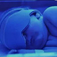 اجاره دستگاه زردی نوزاد (فتوتراپی)