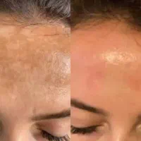 خدمات زیبایی کانتور صورت و ژل و بوتاکس