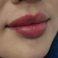 آف ژل بوتاکس مناسبت روز زن|خدمات آرایشگری و زیبایی|ایذه, |دیوار