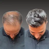 هرروز یک قدم یه بهترین نسخه خودت