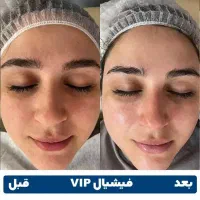 اموزش فیشیال و اکستنشن فقط ۴ تومن و ۳ تومن|خدمات آرایشگری و زیبایی|تهران, شهرک ولیعصر جنوبی|دیوار