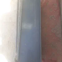 قفسه دست دو