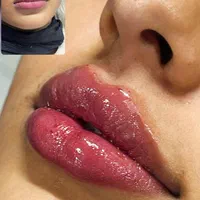 ژل لب تزریق ژل بوتاکس ژل گونه چانه زاویه فک|خدمات آرایشگری و زیبایی|اصفهان, سعادت‌آباد|دیوار