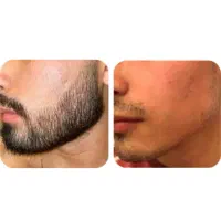 تغییر کن|آرایشی، بهداشتی، درمانی|تکاب, |دیوار
