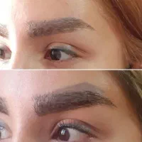 ریموو تتو های قدیمی بدن با دستگاه لیزر کیوسوییچ|خدمات آرایشگری و زیبایی|اردبیل, |دیوار