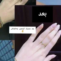 کرم سفید کننده دائمی دست،پا و صورت