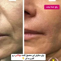 کرم لیفتینگ گاتیو|آرایشی، بهداشتی، درمانی|کرج, شهرک رضوانیه|دیوار