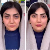 جشنواره زیبایی و لاغری در کلینیک آپیلنس کرج