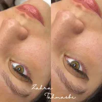 کاشت مژه ،لیفت ابرو‌‌ و مژه