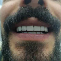 درمانی و زیبایی دندان